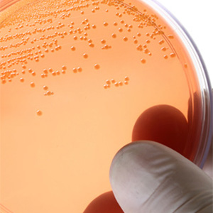 Legionella bacteria culture