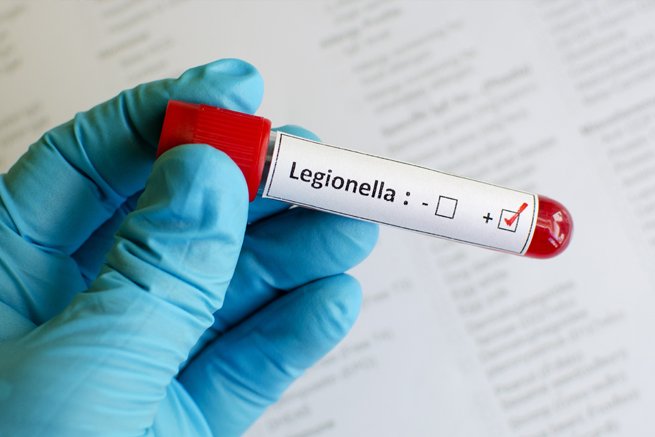 Rapid DNA Test Cuts Time to Detect Potentially Fatal Legionella Bacteria