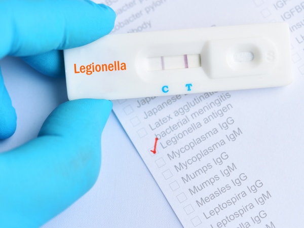 15-point plan for reducing the risk of Legionella